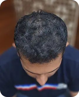 Before After Result