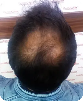 Before After Result